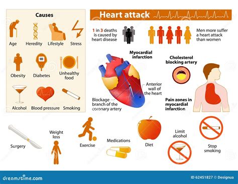 what things are similar to a heart attack
